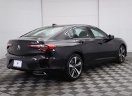 2025 Acura TLX Technology Package With Navigation